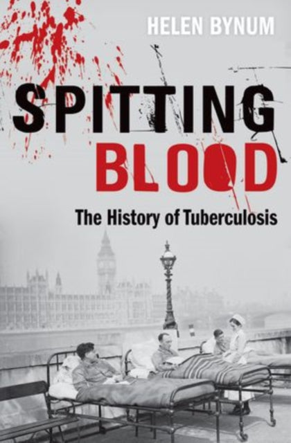 Spitting Blood : The history of tuberculosis