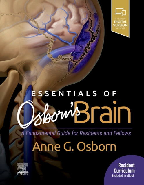 Essentials of Osborn's Brain : A Fundamental Guide for Residents and Fellows