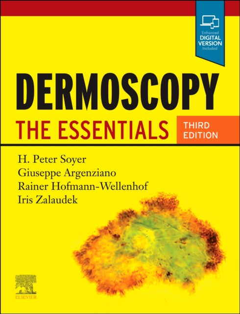 Dermoscopy : The Essentials