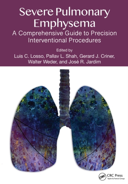 Severe Pulmonary Emphysema: : A Comprehensive Guide to Precision Interventional Procedures