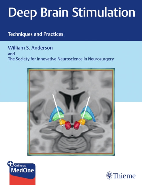 Deep Brain Stimulation : Techniques and Practices