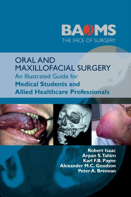 ORAL AND MAXILLOFACIAL SURGERY : An Illustrated Guide for Medical Students and Allied Healthcare Professionals